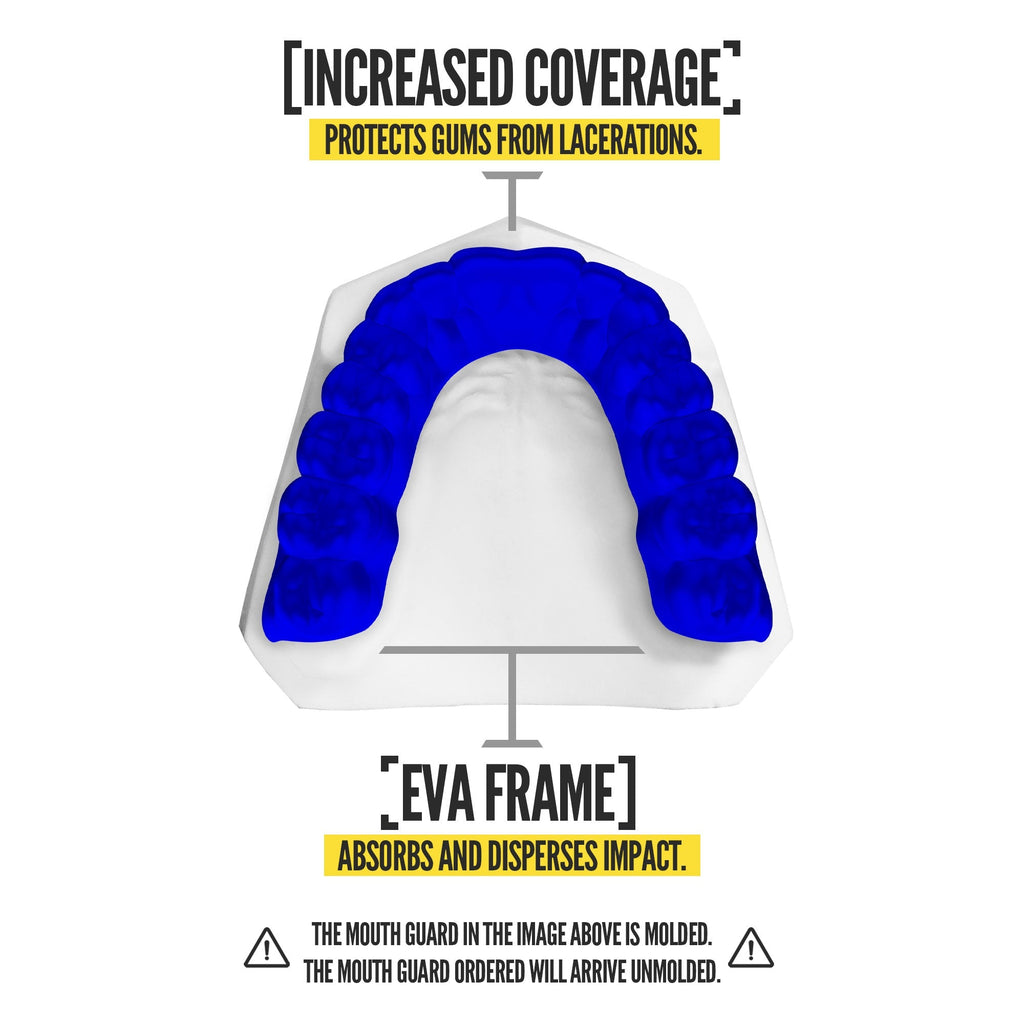 Nxtrnd Classic® Blue (2 Pack)