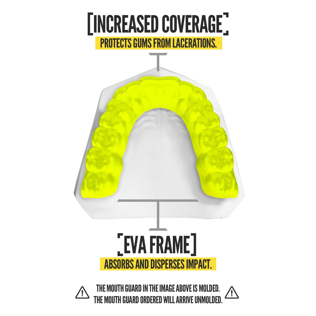 Nxtrnd Classic® Neon Yellow (2 Pack)